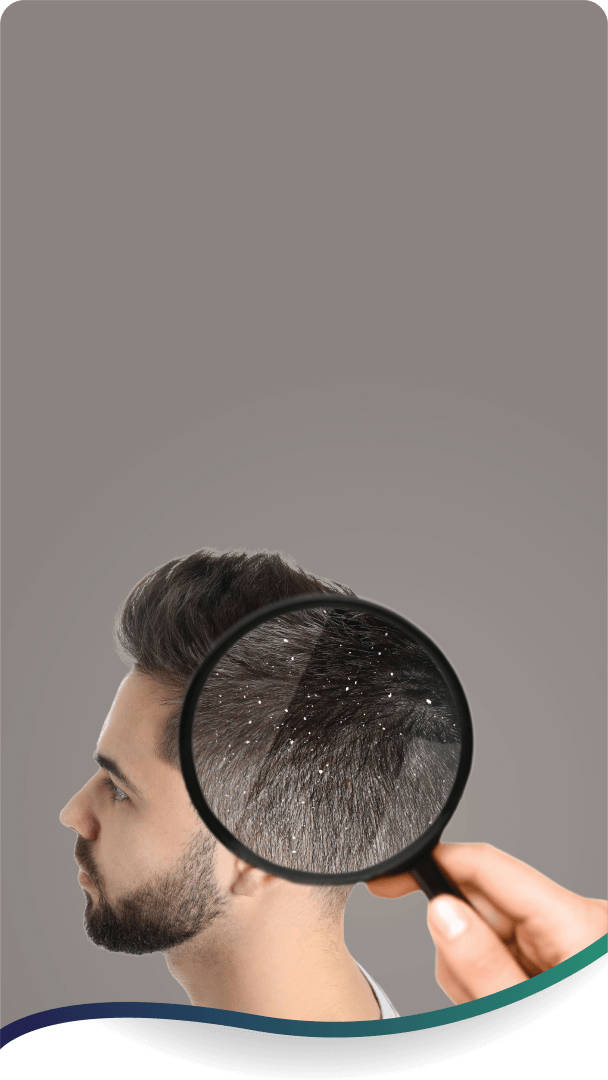 Anti dandruff treatment